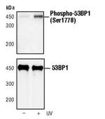 Phospho-53BP1 (Ser1778) Polyclonal Antibody