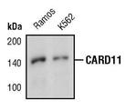 CARD11 Polyclonal Antibody