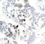 Phospho-Histone H3 (Thr3) Antibody in Immunohistochemistry (Paraffin) (IHC (P))