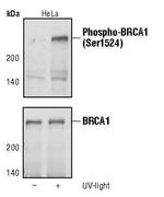Phospho-BRCA1 (Ser1524) Polyclonal Antibody