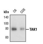 TAK1 Polyclonal Antibody