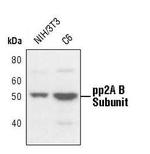 PPP2R2A Polyclonal Antibody