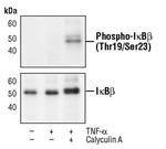 Phospho-IkB beta (Thr19, Ser23) Antibody