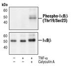 Phospho-IkB beta (Thr19, Ser23) Polyclonal Antibody