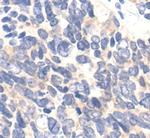 Ezrin Polyclonal Antibody