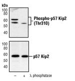 Phospho-p57 Kip2 (Thr310) Antibody in Western Blot (WB)
