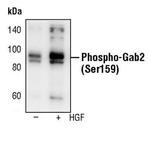 Phospho-GAB2 (Ser159) Polyclonal Antibody