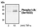 Phospho-IkB epsilon (Ser18, Ser22) Antibody in Western Blot (WB)