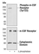 CSF1R Polyclonal Antibody