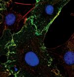 PKC alpha Antibody in Immunocytochemistry (ICC/IF)