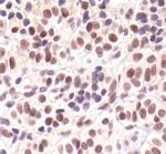 Phospho-Cyclin E (Thr62) Antibody in Immunohistochemistry (Paraffin) (IHC (P))