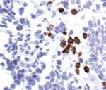 UBC3B Antibody in Immunohistochemistry (IHC)