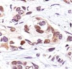 Phospho-p53 (Ser33) Antibody in Immunohistochemistry (Paraffin) (IHC (P))