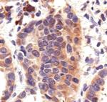 HSP70 Antibody in Immunohistochemistry (IHC)