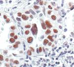 GTF2I Antibody in Immunohistochemistry (Paraffin) (IHC (P))