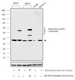 Acetyl-p53 (Lys382) Antibody in Western Blot (WB)