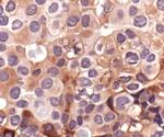 Phospho-HSP27 (Ser78) Antibody in Immunohistochemistry (Paraffin) (IHC (P))