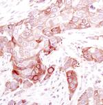 Stathmin 1 Antibody in Immunohistochemistry (Paraffin) (IHC (P))