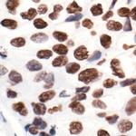 H2AK5ac Polyclonal Antibody