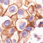 Phospho-SRC (Tyr530) Antibody in Immunohistochemistry (Paraffin) (IHC (P))