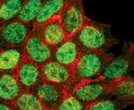 Phospho-p53 (Ser46) Antibody in Immunocytochemistry (ICC/IF)