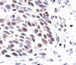 H3K9ac Antibody in Immunohistochemistry (IHC)