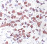 Phospho-ATF2 (Thr71) Antibody in Immunohistochemistry (IHC)