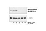 Phospho-beta Catenin (Ser33, Ser37, Thr41) Antibody in Western Blot (WB)