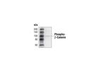 Phospho-beta Catenin (Ser33, Ser37, Thr41) Antibody in Western Blot (WB)