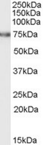 FEM1C Polyclonal Antibody