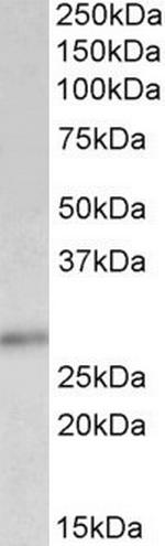 p27 Kip1 Polyclonal Antibody