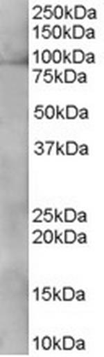 XAB2 Antibody in Western Blot (WB)