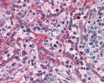 TMX Antibody in Immunohistochemistry (Paraffin) (IHC (P))
