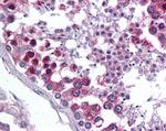 TMX Antibody in Immunohistochemistry (Paraffin) (IHC (P))