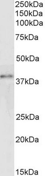 GRAP2 Polyclonal Antibody