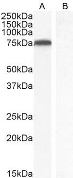 ITK Antibody in Western Blot (WB)