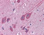 STAP2 Antibody in Immunohistochemistry (Paraffin) (IHC (P))