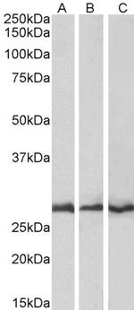CAPZB Antibody in Western Blot (WB)