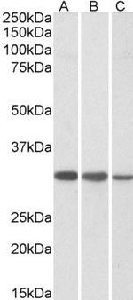 CAPZB Polyclonal Antibody