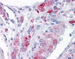 MTA1 Antibody in Immunohistochemistry (Paraffin) (IHC (P))