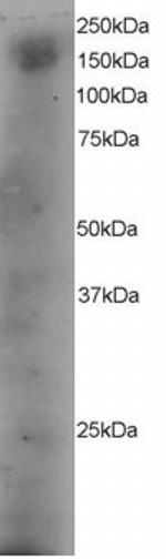 DOCK1 Polyclonal Antibody