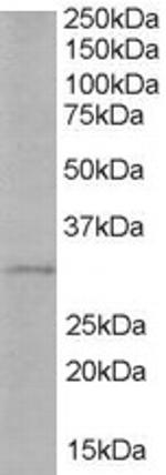 TIRAP Polyclonal Antibody