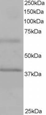 BPOZ Antibody in Western Blot (WB)