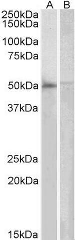 DOK3 Antibody in Western Blot (WB)