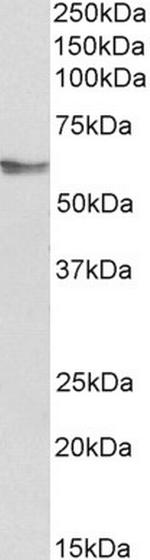 FGR Polyclonal Antibody
