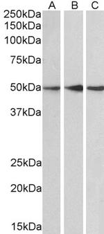 PPP2R5E Antibody in Western Blot (WB)