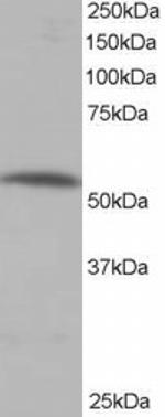PPP2R5A Antibody in Western Blot (WB)