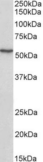 ATF7 Antibody in Western Blot (WB)