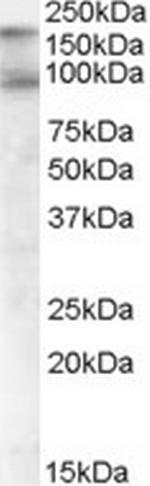 CDCP1 Antibody in Western Blot (WB)