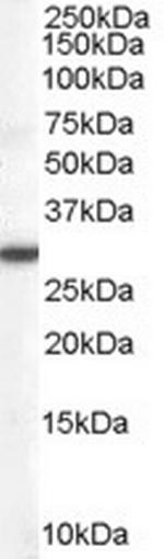 DDAH2 Antibody in Western Blot (WB)